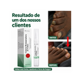 Caneta Restauradora de Unhas – Repara, Fortalece e Renova