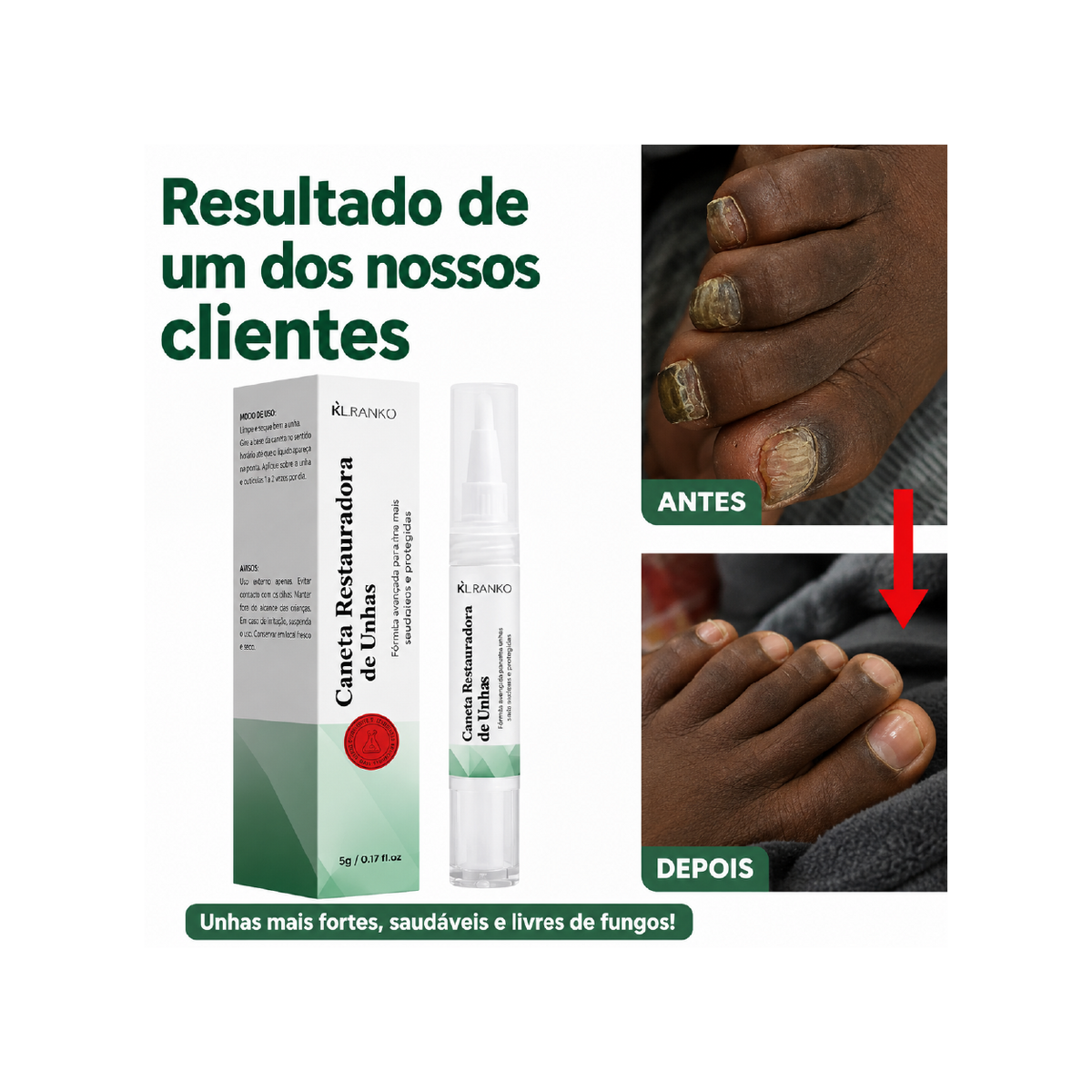 Caneta Restauradora de Unhas – Repara, Fortalece e Renova